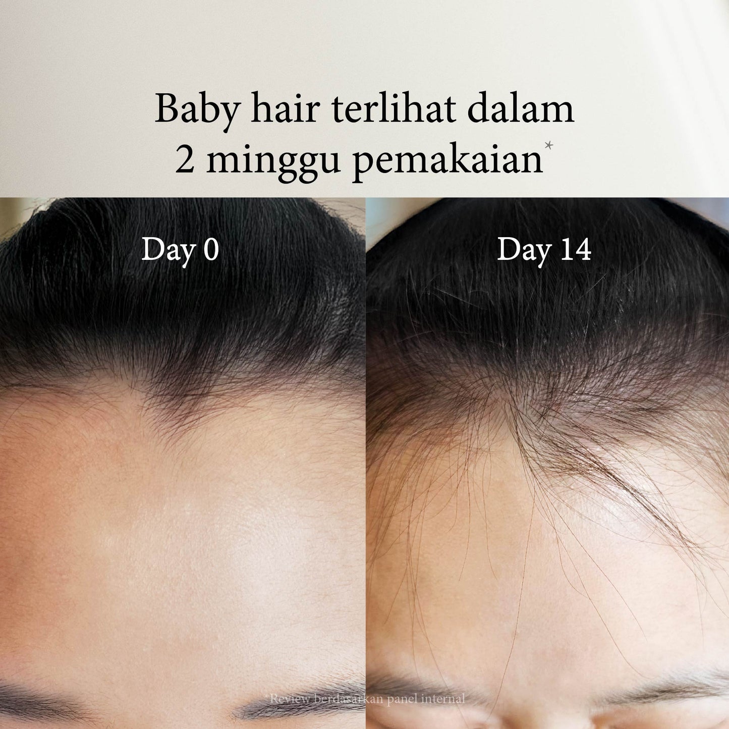 Flower Alley SLS-free Hairfall Shampoo | Perawatan Rambut Rontok | Penumbuh Rambut | Cegah Rontok