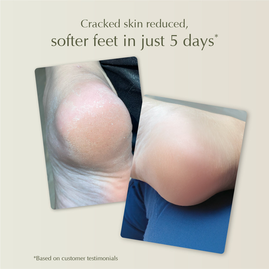 Cooling Foot Spray 50ml | Refreshing Foot Spray | Penghilang Bau Kaki