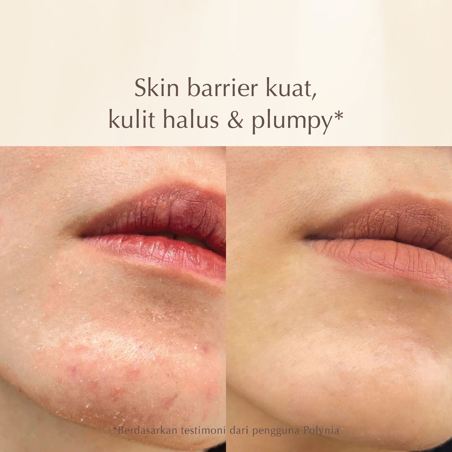 Prickly Pear Hydrating Face Mask | Nutrisi kulit & Memperkuat Skin Barrier | Jaga kelembapan kulit | BPOM
